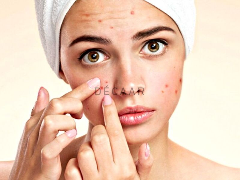 Có nên tự nặn mụn
